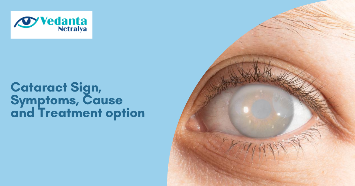 Cataract Sign, Symptoms, Cause and Treatment option