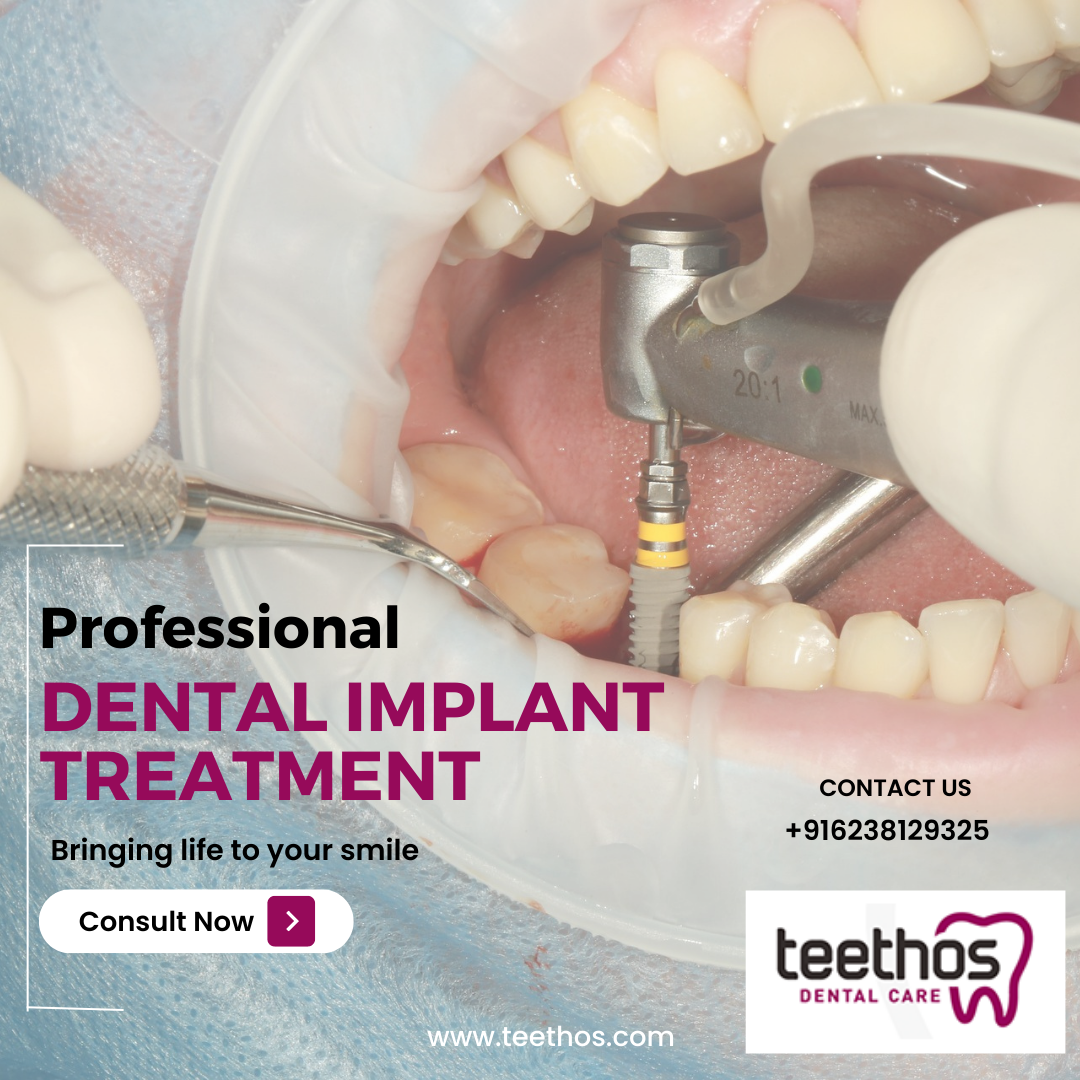 How to Recognize the Dental Implants Cost in Kochi That's Right for You?