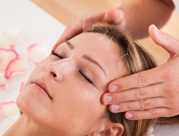 Acupuncture Therapy in Mumbai: Why It’s a Go-To for Natural Healing!!