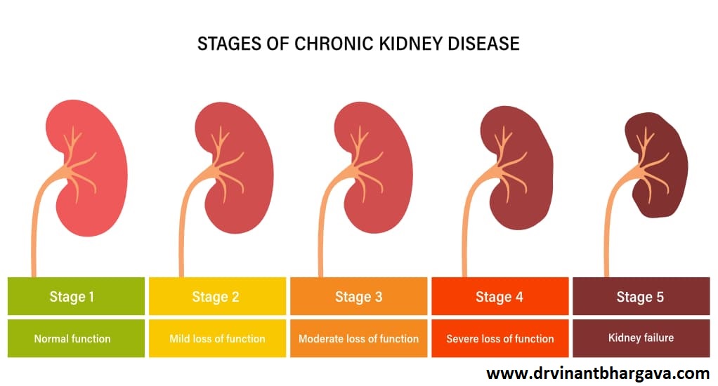 Is Chronic Kidney Failure Curable?