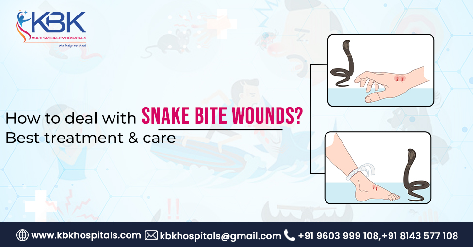 snake bite hospital in hyderabad
