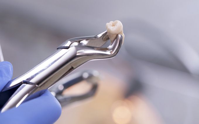 Finding the right Cypress Tx Dentist