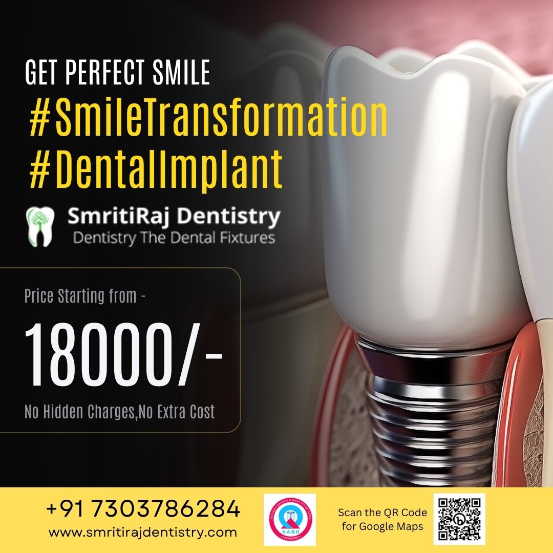 What are the key considerations when selecting a dental implant specialist in my local area?