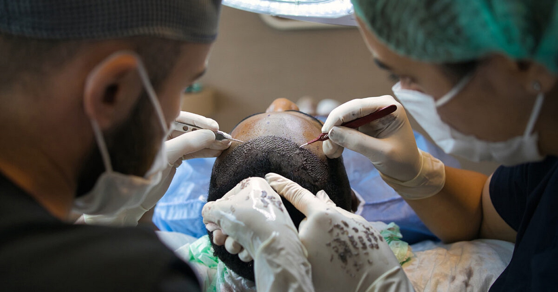 Advantages and disadvantages of hair transplant