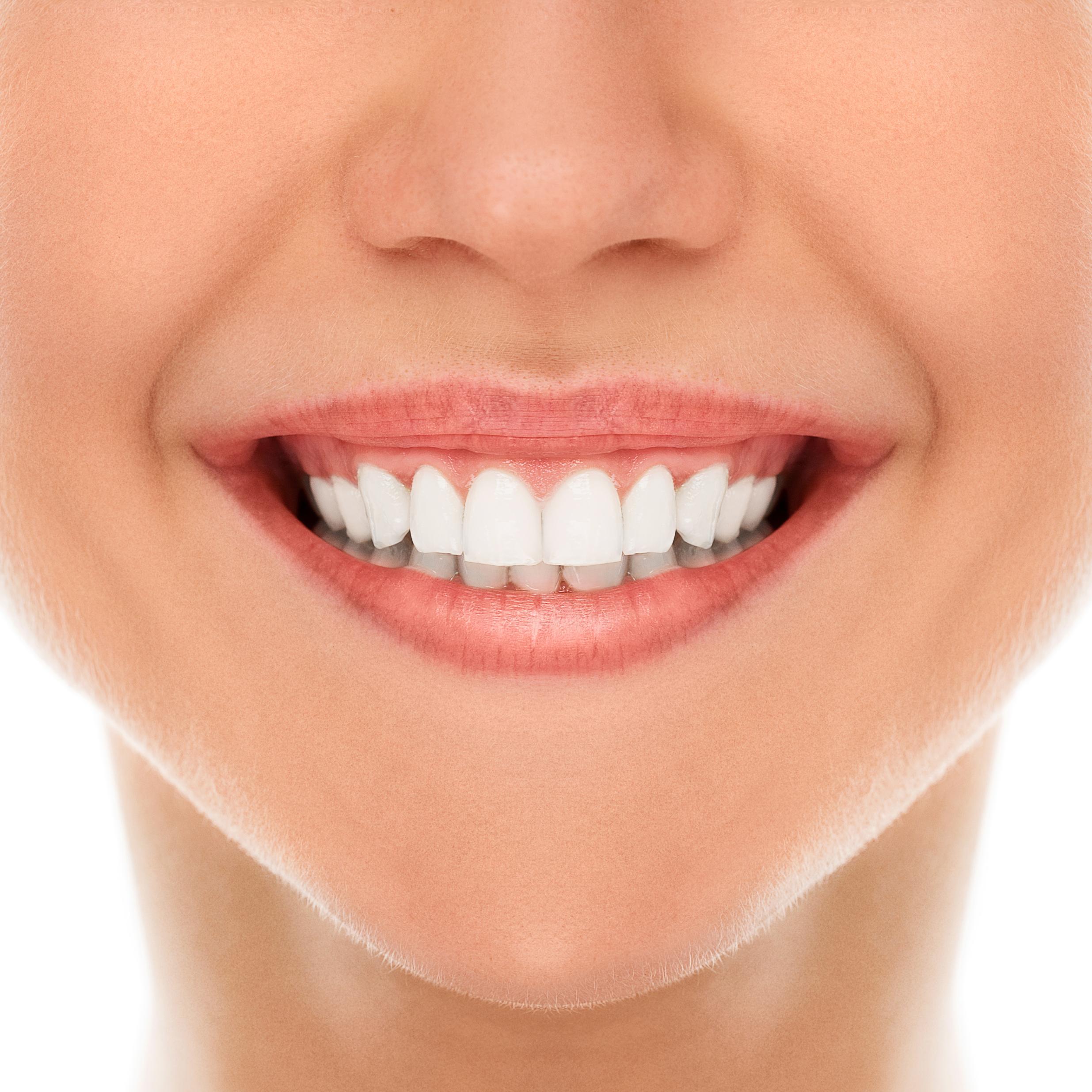 What everybody ought to know about dental veneers?