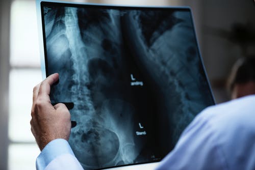 Interventional Neurologist
