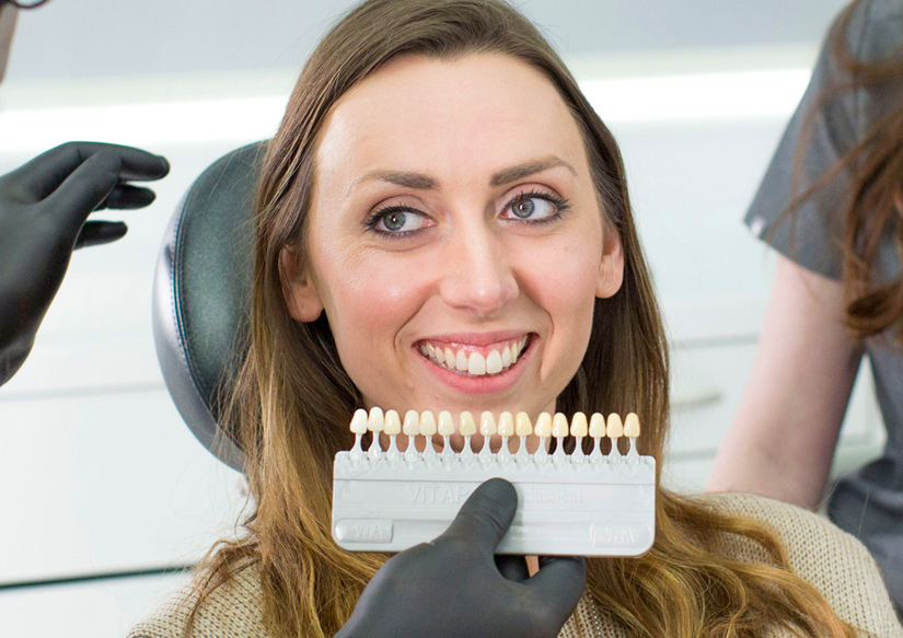 Professional Teeth Whitening At the Dentist in Saskatoon
