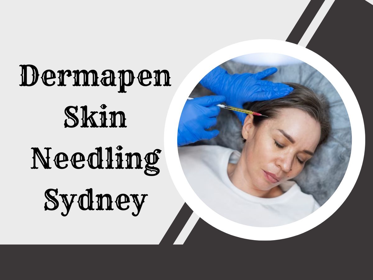 Understanding the Basics of Dermapen Skin Needling - An Overview