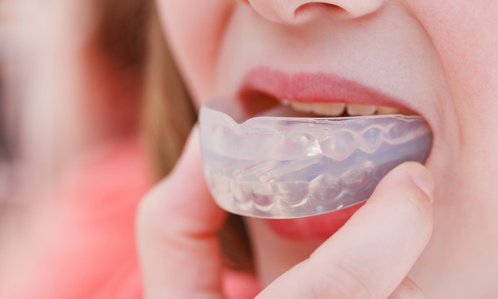 Mouthguard: Advantages And Disadvantages