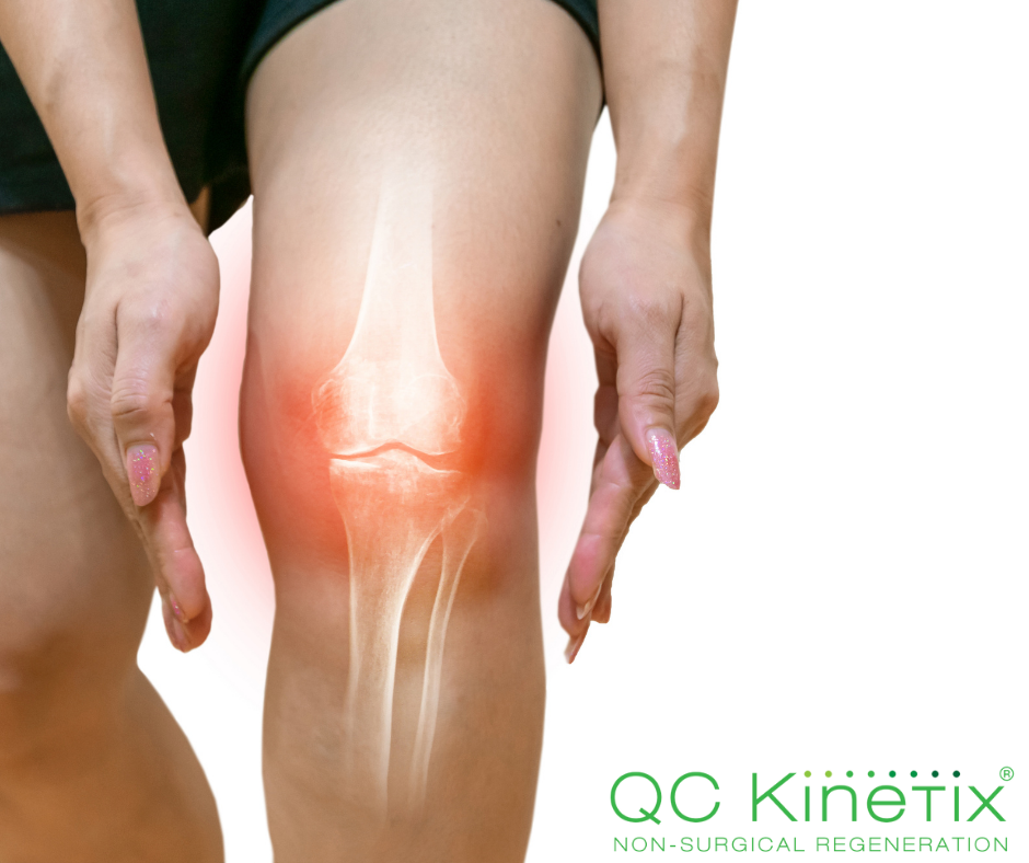 What causes sports injuries & how to prevent them