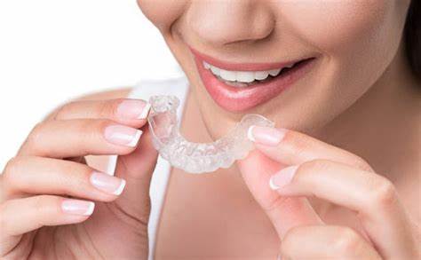 All You Need to Know About Invisalign