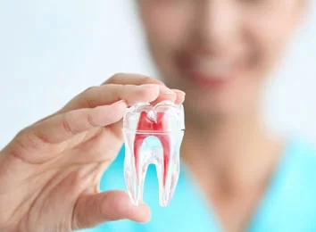 Everything You Need to Know About Getting a Root Canal