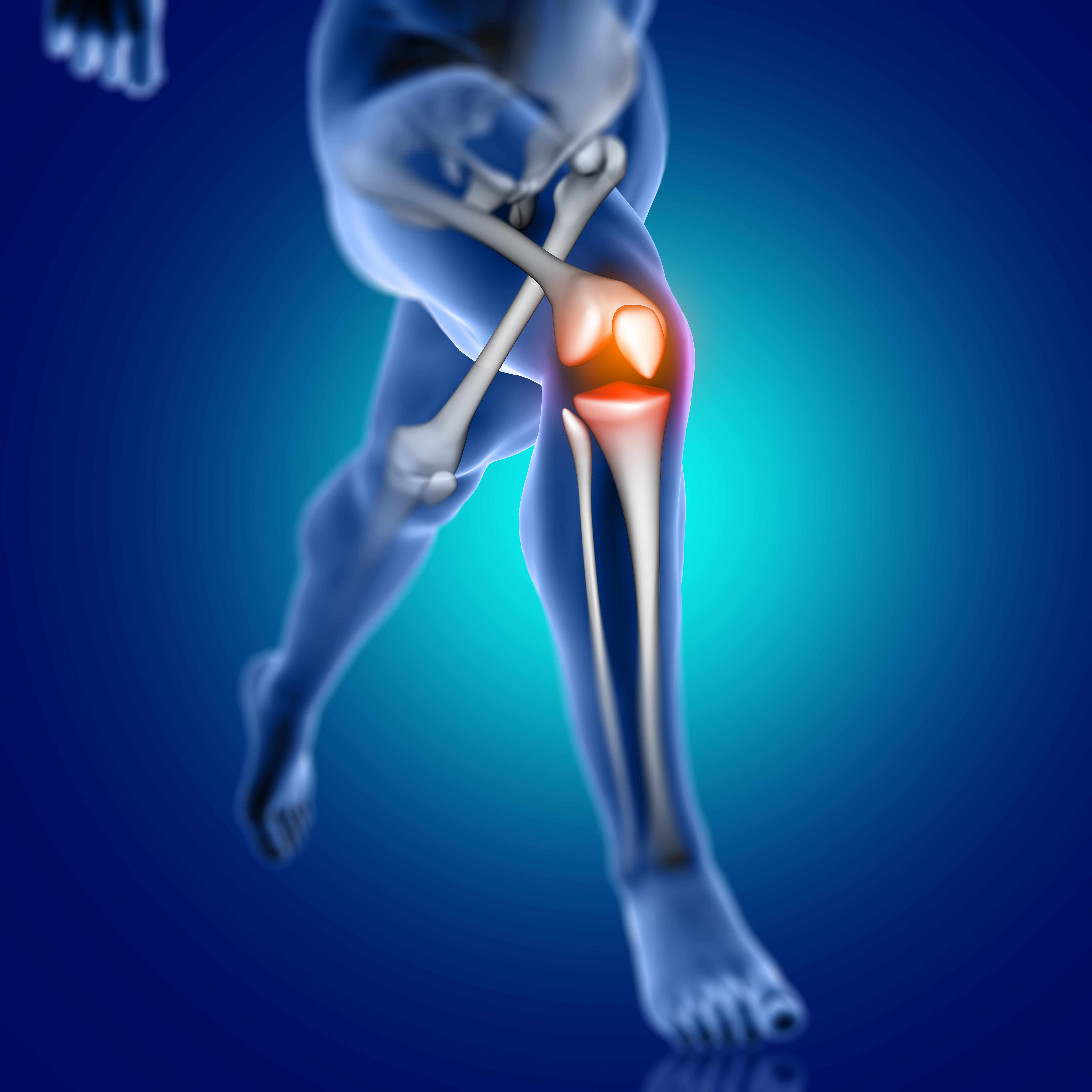 5 Natural Ways to Treat Arthritis Pain and Support Healthy Joints