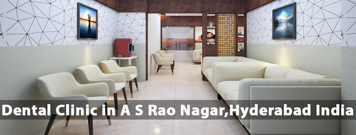 Best Dental Clinic In Chanakyapuri | Best Dental Hospital In Chanakyapuri | Best Dental Clinic In A S Rao Nagar