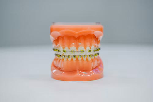 How Long Does a Tooth Last After a Root Canal?