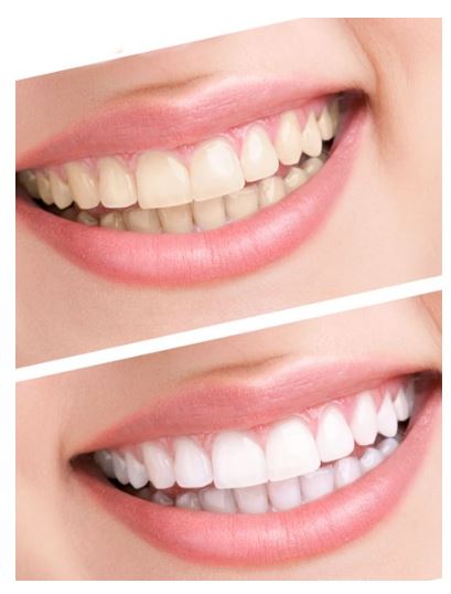 Easier to keep teeth shining and healthier 
