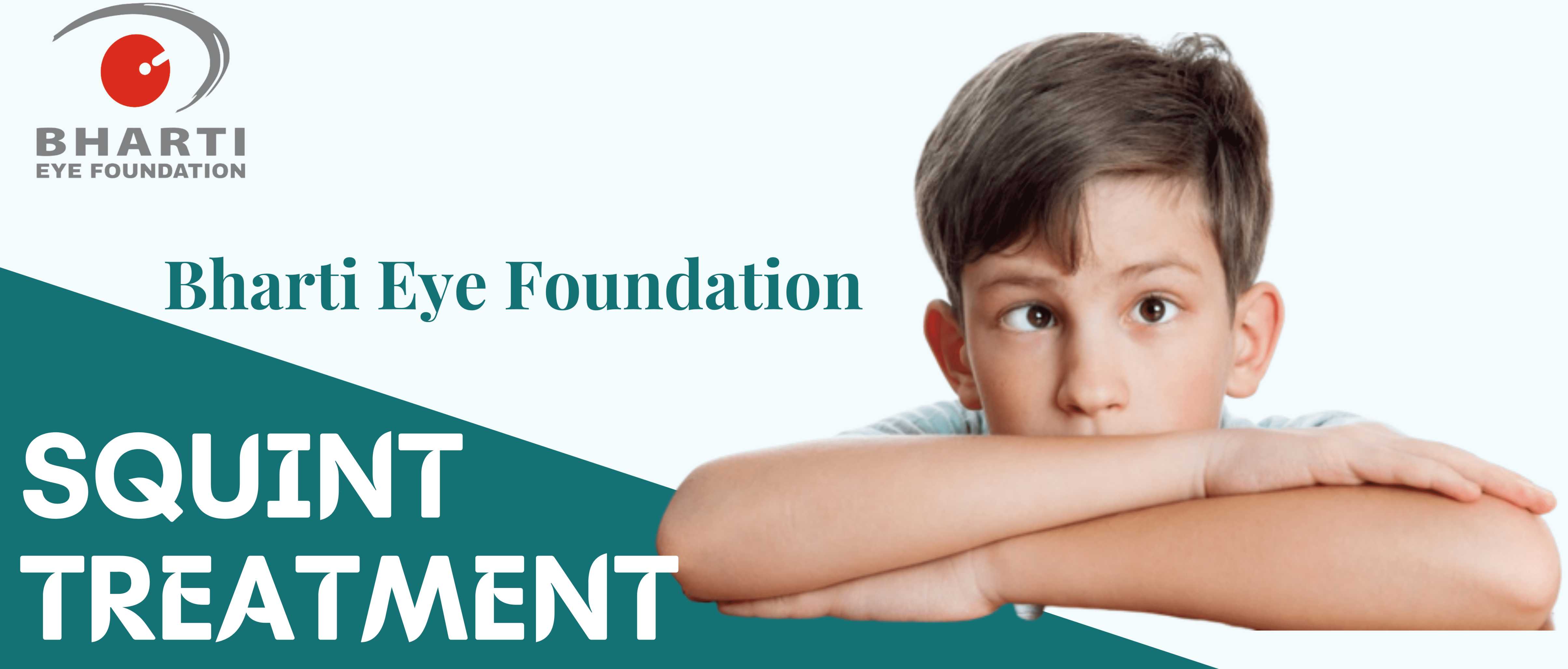 Squint Treatment – Bharti Eye Foundation