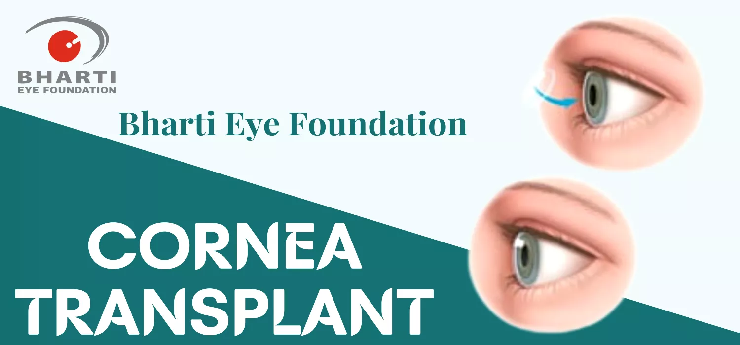 Cornea Transplant Surgery: What You Need to Know