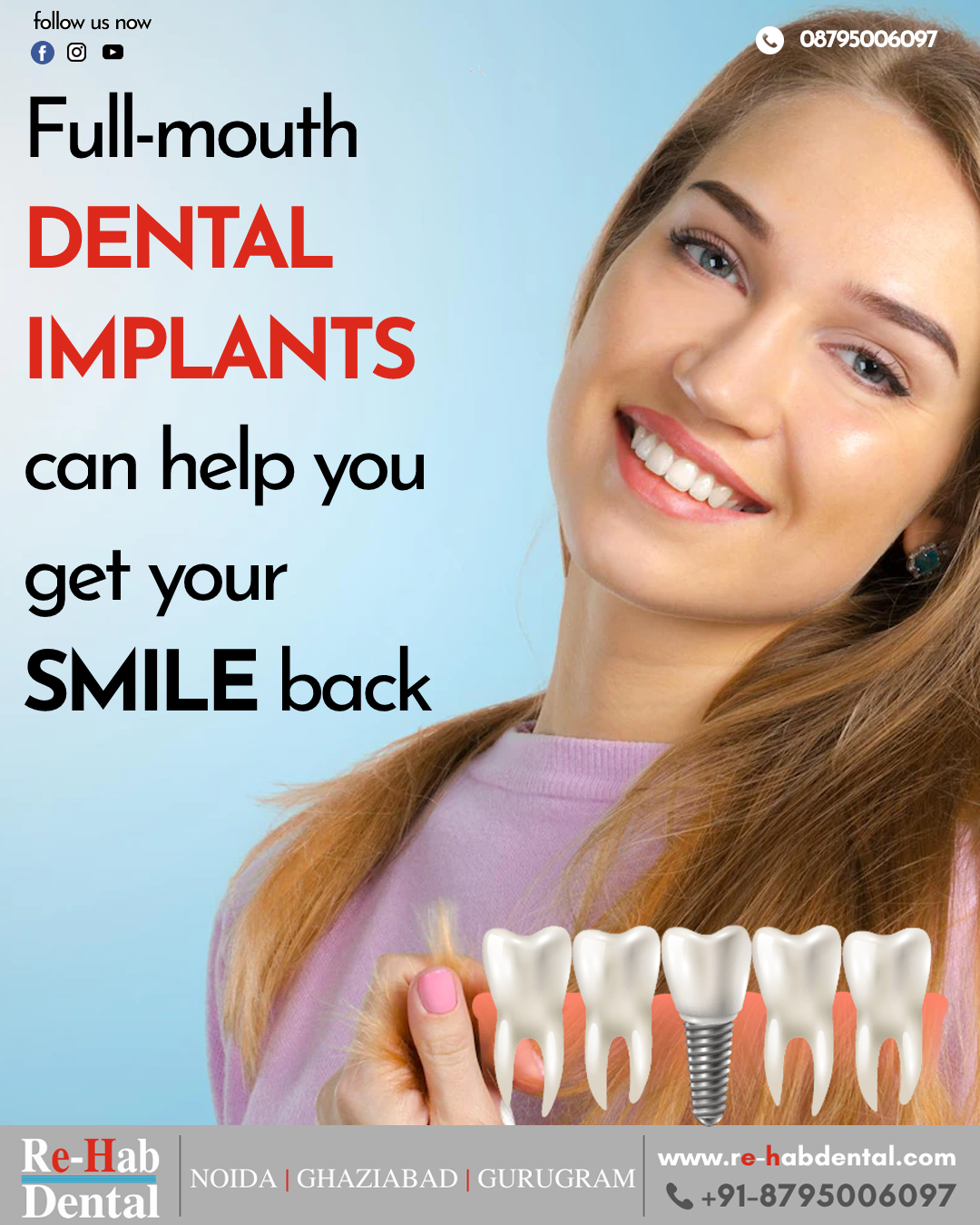 Achieve A Brighter Smile With The Best Dental Implant Clinic In Noida
