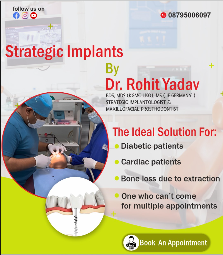 The Training Behind the Surgeon - What Makes Dr. Rohit Yadav Strategic Implantologist Different From Everyone Else in Noida​