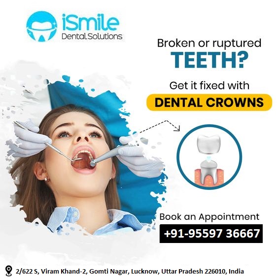 Best Dental Clinic in gomti nagar lucknow