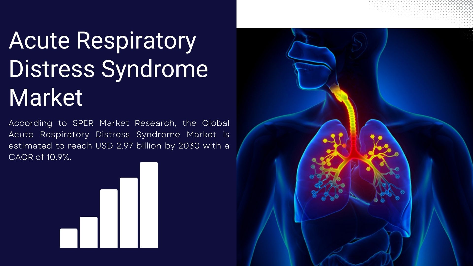Global Acute Respiratory Distress Syndrome Market is projected to be worth USD 2.97 billion by 2030