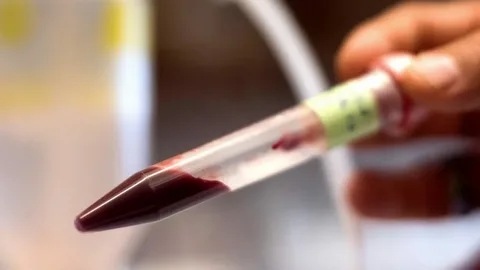 Artificial Blood Market Type, By Application and By Region, Forecast From 2022-2028