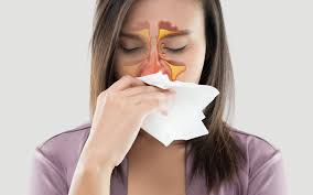 Buy homeopathic remedies for sinus pressure