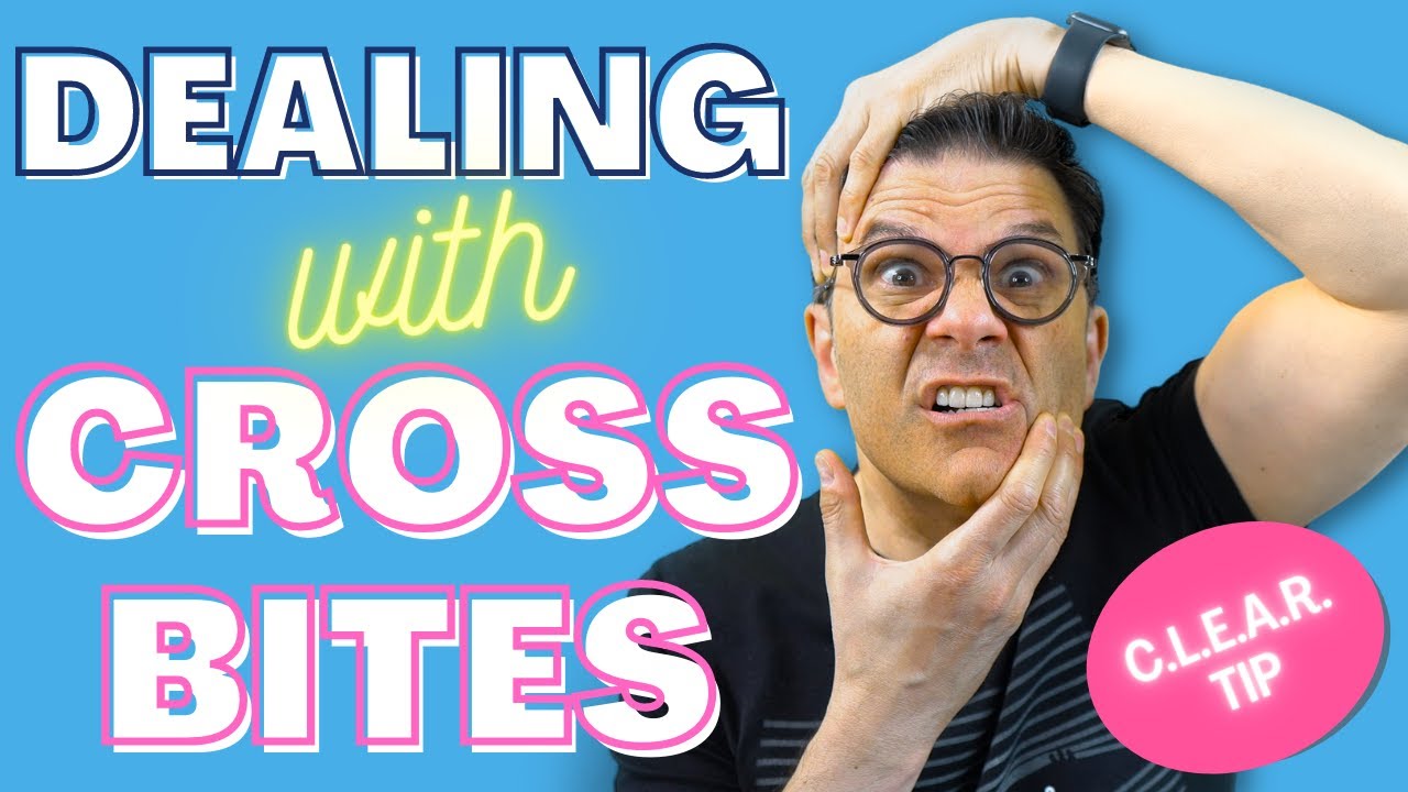 Identifying Crossbite: Common Symptoms You Should not Ignore