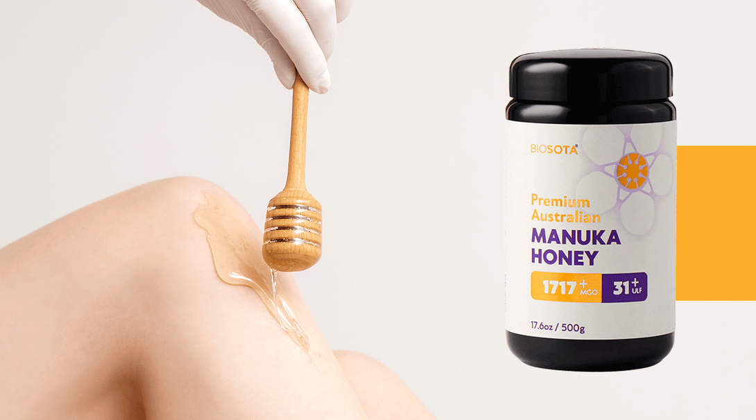 WOUNDS: MANUKA HONEY BENEFITS FOR WOUNDS AND ULCERS