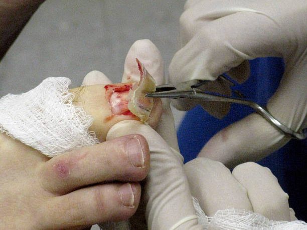 Podiatrist Macomb MI: Comprehensive Care at Warren Podiatry