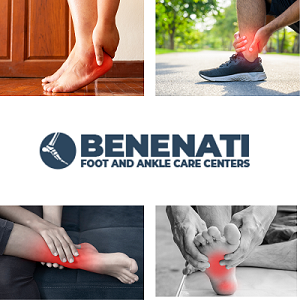 Symptoms and causes of Plantar Fasciitis