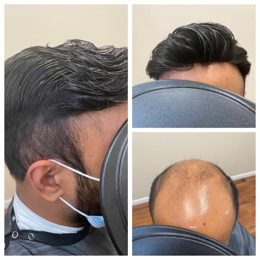 Men look attractive and unique with mens toupee