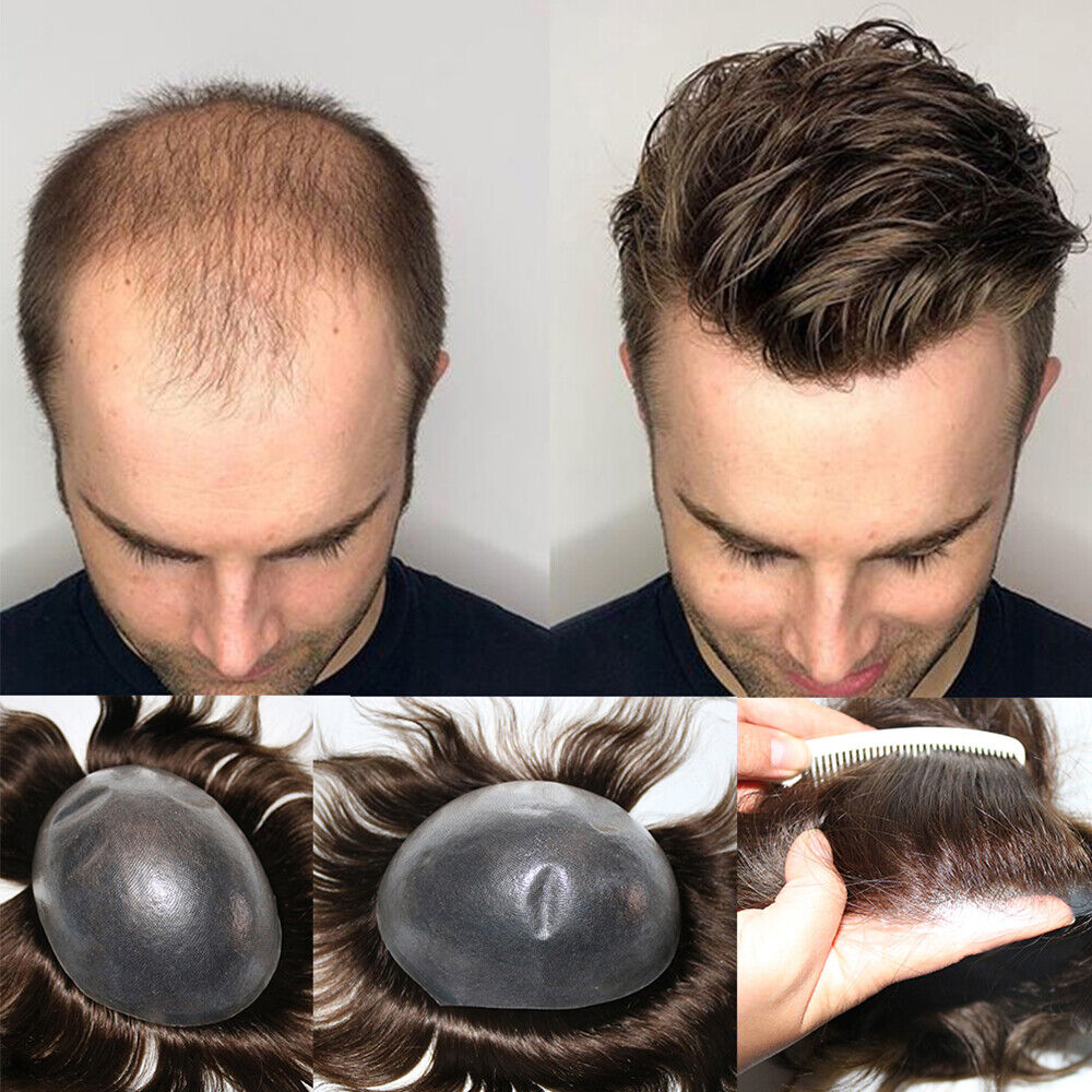 Toupee and Hair Systems for Men - Clear Your Doubts Before Buying