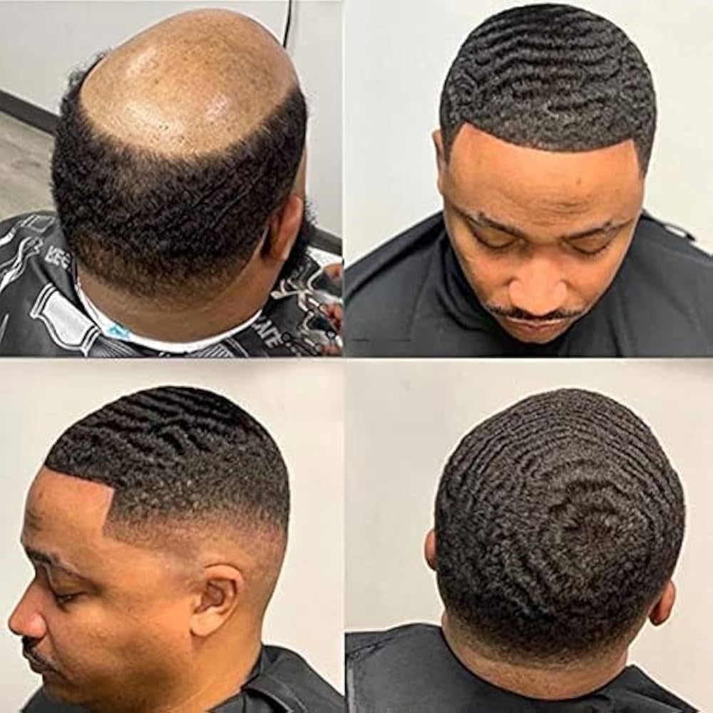 Mens Hair pieces and Hair Direct Are Moving Forward and are also easier to remove
