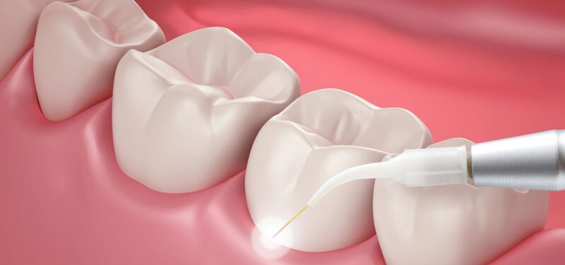 gum specialist in mumbai