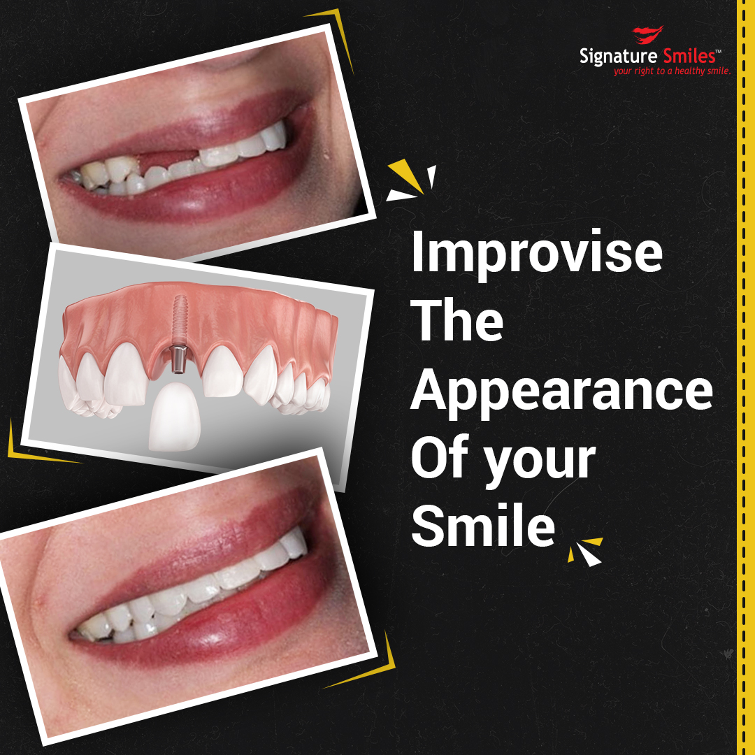 Dental Clinic in Mumbai