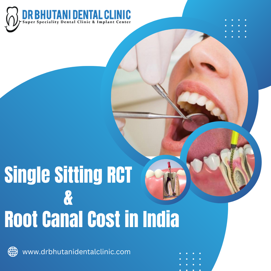 Single Sitting RCT and Root Canal Cost In India