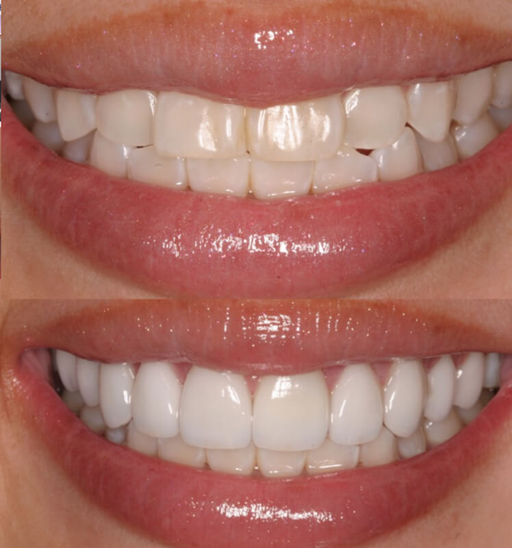 Emergency dentist Ottawa | Orleans clinic | Ottawa dental implant surgery