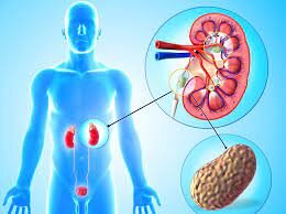 Kidney Failure, Reasons, Symptoms & Treatment