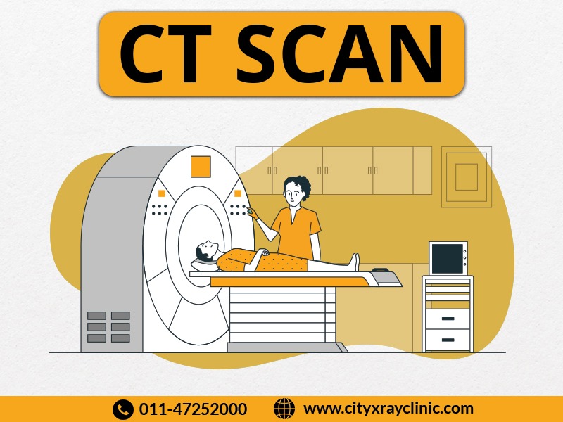 CT Scan centre in Delhi NCR