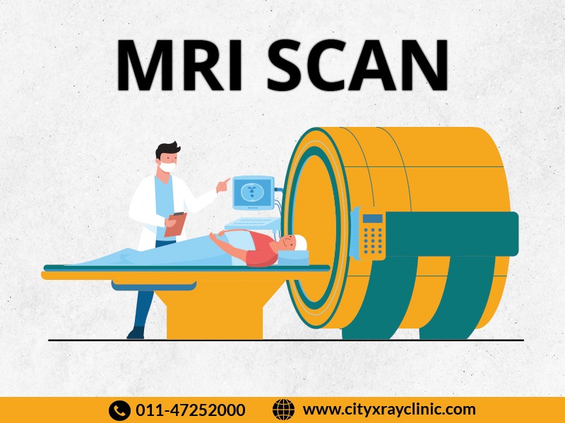 Best Mri Scan near me