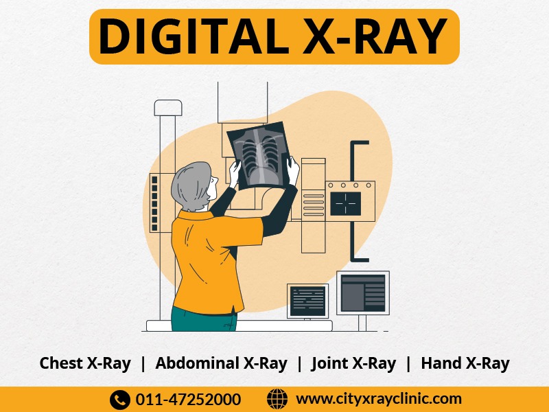 Digital X Ray centre near me in Delhi NCR
