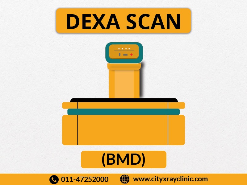 DEXA SCAN Price in Delhi NCR