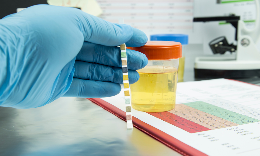 How to Use Synthetic Urine For Pranks