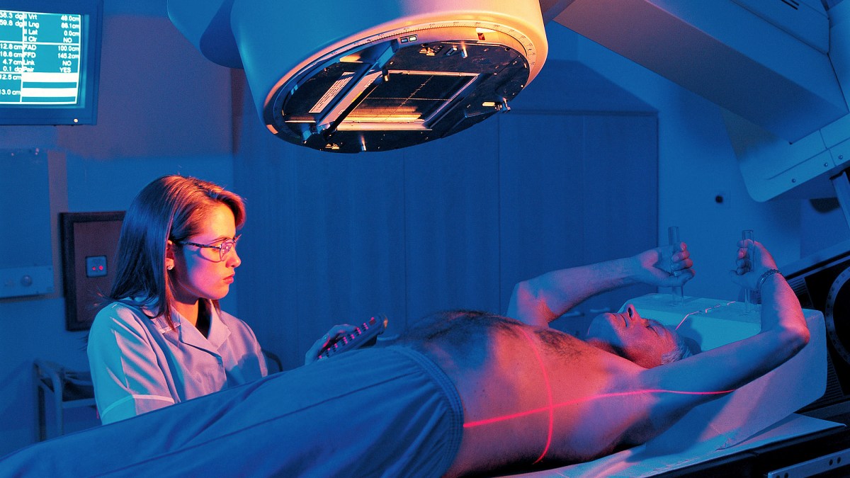 Radiotherapy Reflections: Insights into Modern Cancer Care