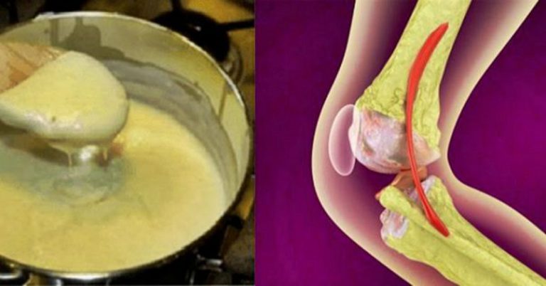 Bone and Joint Health Ingredients Market Scope 2022- 2028 Business Overview, Leading Manufacturers Analysis