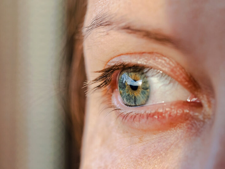 Dry Eye Disease Market: Transforming Treatment Approaches for Dry Eyes