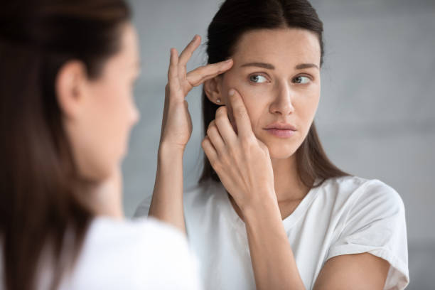  What Are Signs Of Aging In the 30s?