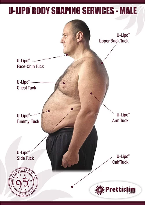 TUMMY TUCK — PRETTISLIM CLINIC